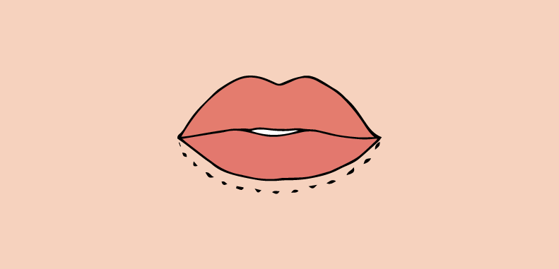 labbro inferiore sottile