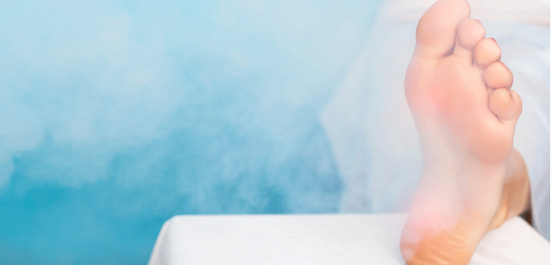 crioterapia verruche