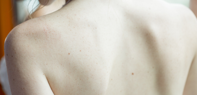 schiena prodotti cosmetici