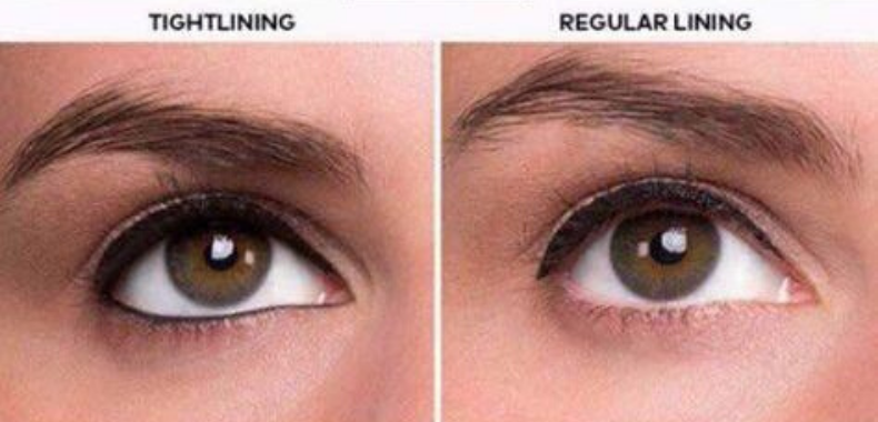 Tightlining-differenze