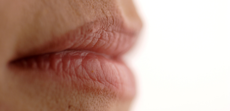 contorno labbra rughe