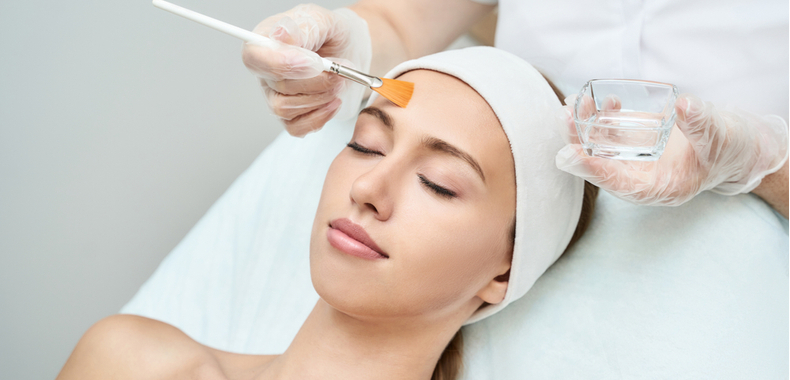 peeling viso chimico