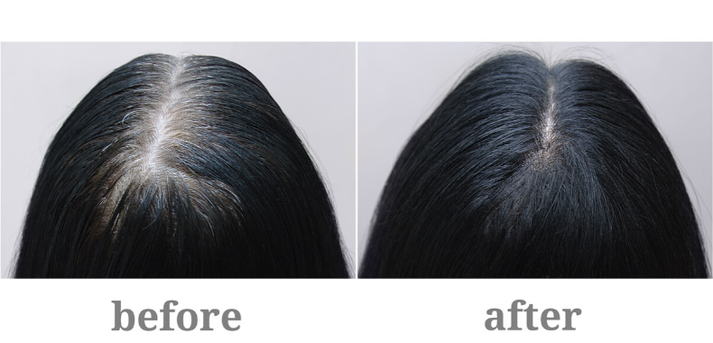 spray-capelli