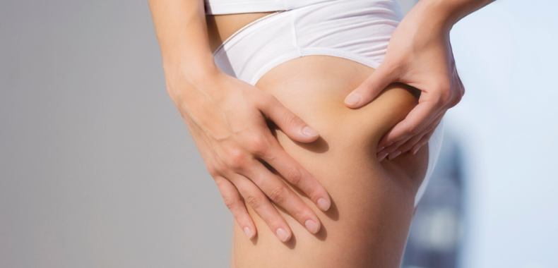 centella-asiatica-cellulite