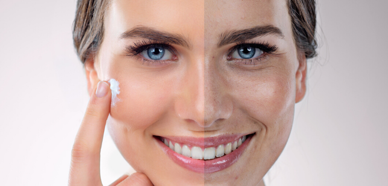 niacinamide-skincare