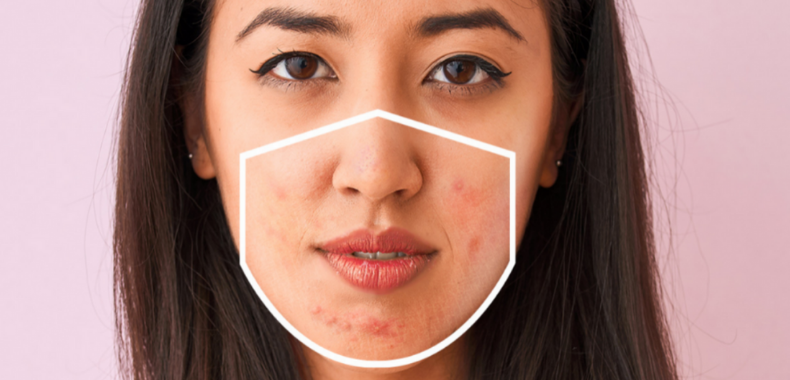 maskne-skincare-pelle