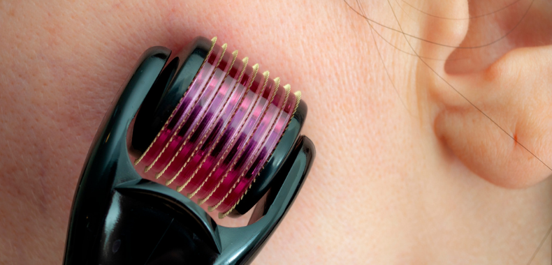 dermaroller-utilizzo