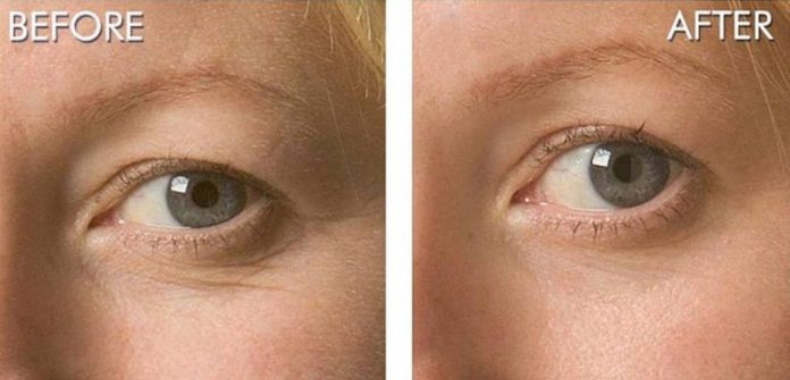 ossigenoterapia prima dopo