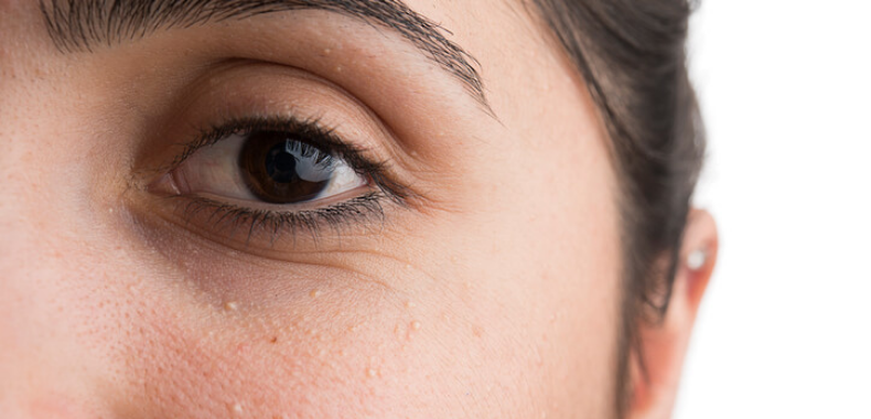 grani di miglio occhi