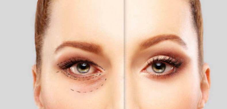 ringiovanire sguardo trucco