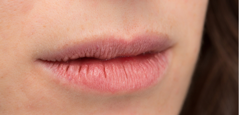 caratteristiche pelle secca