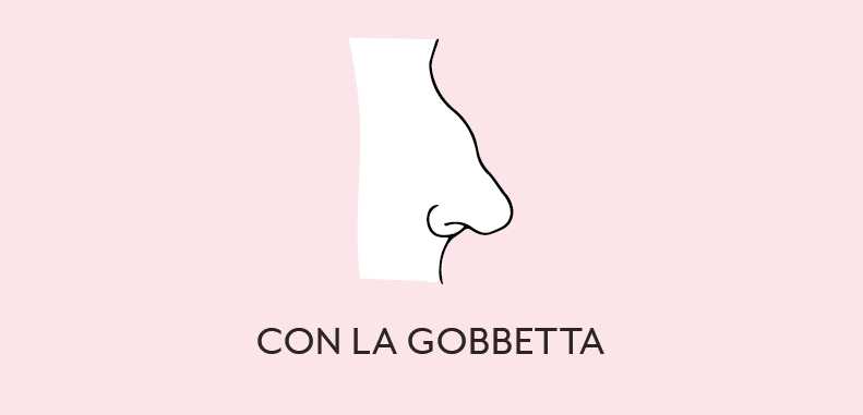 naso con la gobbetta