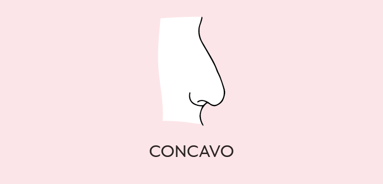 naso concavo