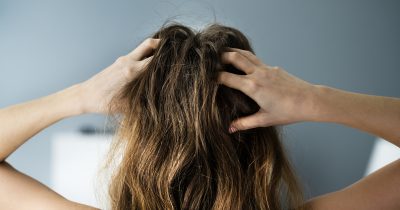 Prurito cuoio capelluto: cause, rimedi e consigli