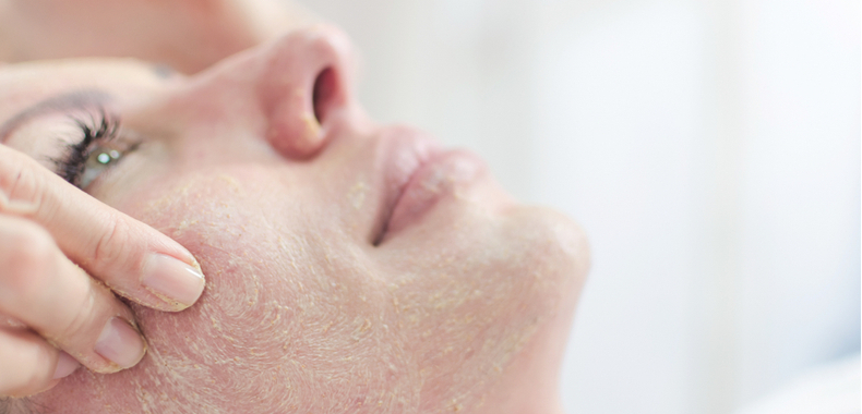 peeling enzimatico how to