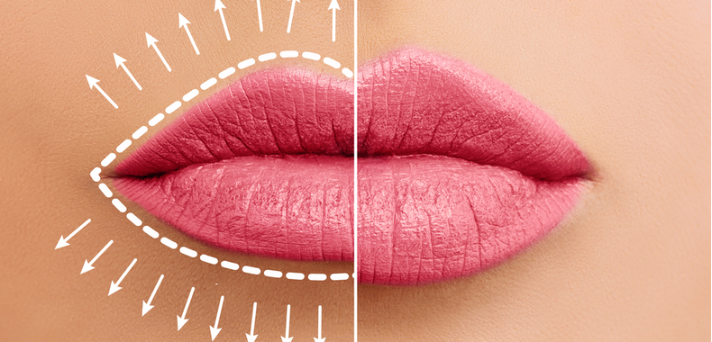 Aumento volume naturale